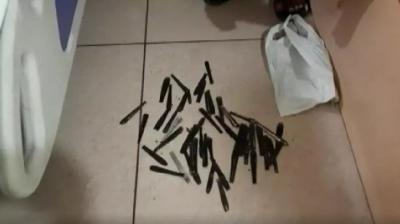  63 spoons came out of the young man's stomach, the young man was admitted to the drug addiction center for 5 months