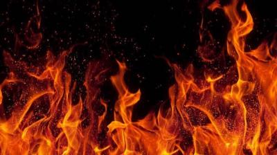 Representative Image.