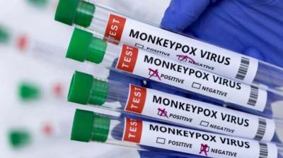 No Sexually Transmitted Infections Found In 5 Monkeypox Cases In Delhi: ICMR Study