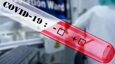 Number of positive patients of corona virus in chandigarh 27 recovered 14