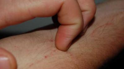 Image for representation purpose only