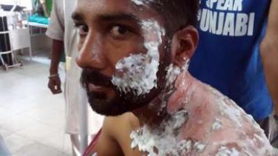 Tea Boy threw hot tea on youth