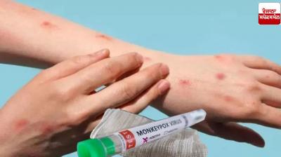Another case of Mockpox found in India