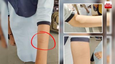 Gujarat: More than two dozen children injure themselves while playing 'dare game'