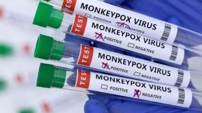 Second Monkeypox case confirmed