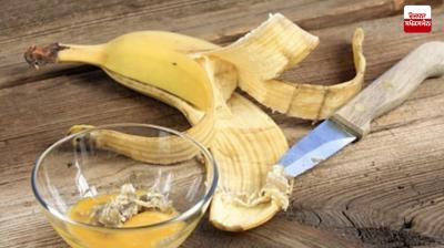  Shine your teeth with banana peel