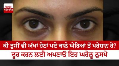 Are you also bothered by dark circles under your eyes?