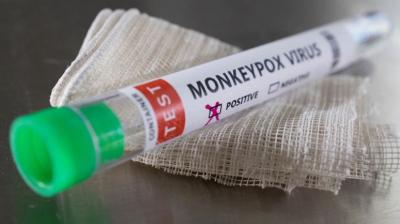 Monkeypox only spreads via air during 'sustained' face-to-face contact: CDC