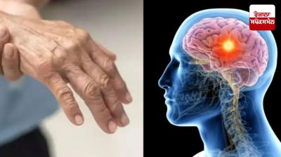 First death due to Guillain-Barre Syndrome in Pune News