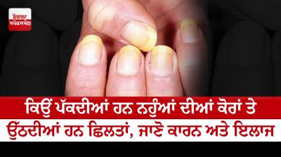 Why do the nails grow on the cores, know the causes and treatment
