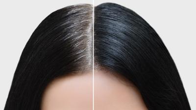 Home Remedies for Grey Hair