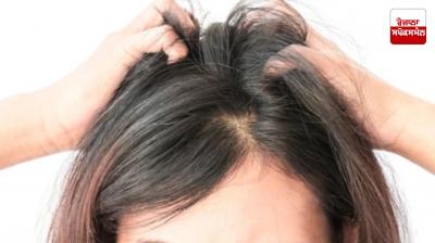 Home remedies will provide relief from itchy scalp