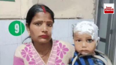 One and a half year old girl burnt by hot dal in Ludhiana