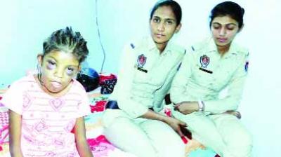 Girl beaten very badly by step mother