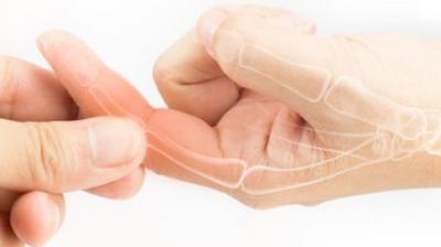 hand swelling problem