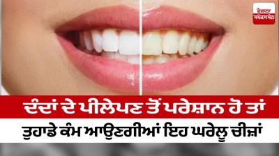 If you are worried about the yellowness of your teeth then these home remedies will come in handy