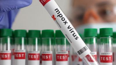 India need not fear Mpox virus, use these precautions