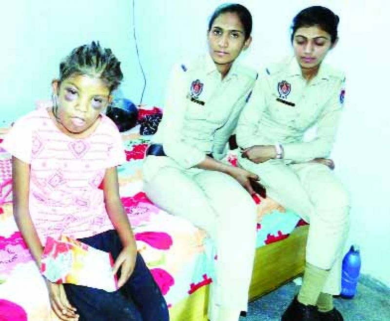 Girl beaten very badly by step mother