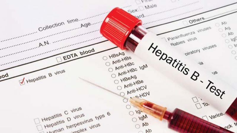 Hepatitis B Test