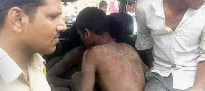 Tribals Stripped Naked Beaten
