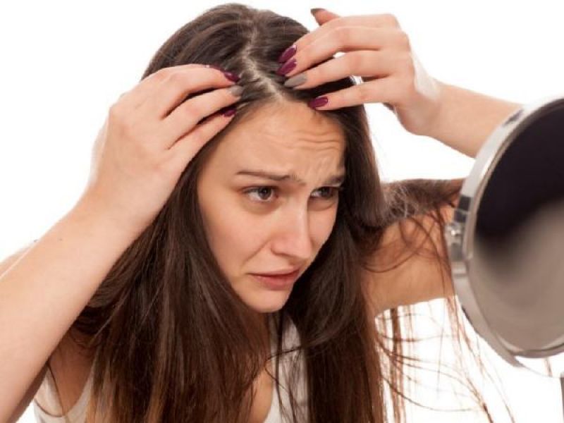 Dandruff treatment household tips