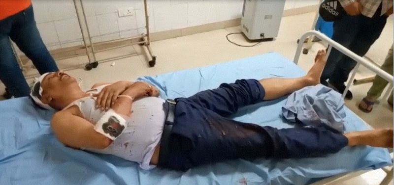 Brutally beaten Father