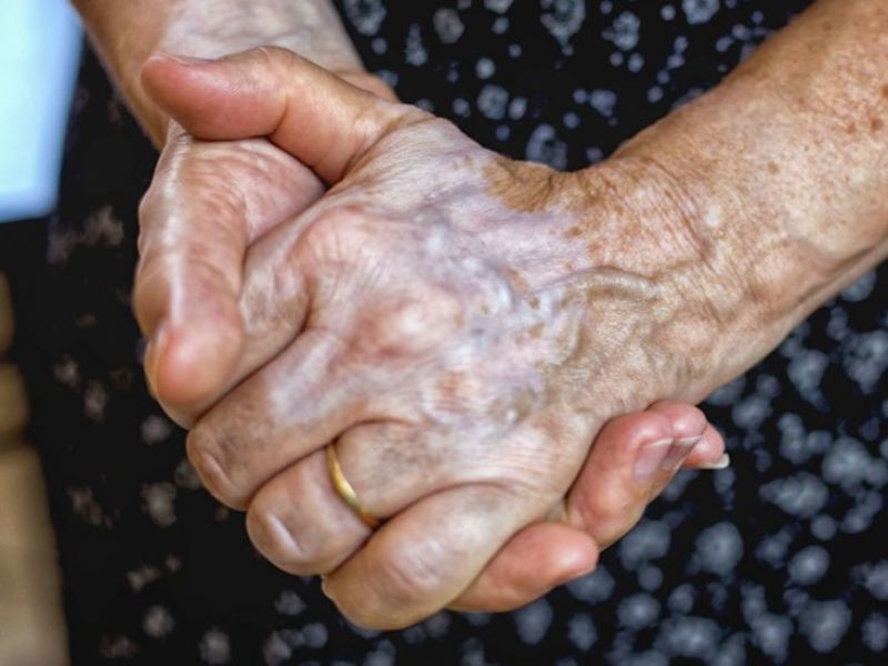 Visible veins on the body can cause major problems