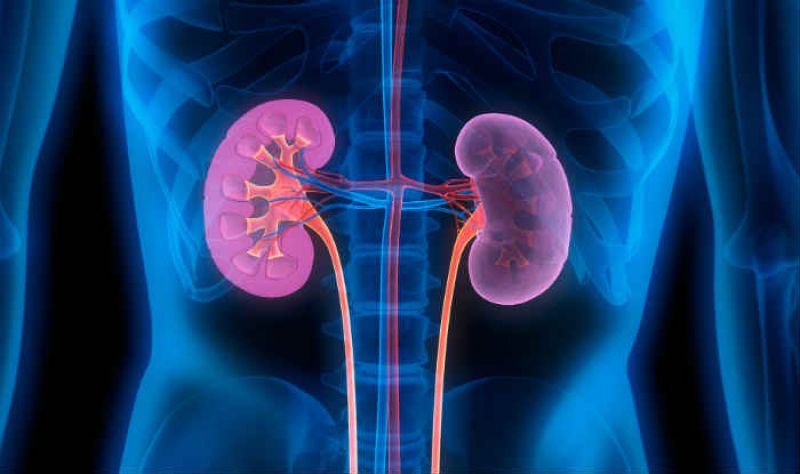 Doctors removed the kidney woman while the operation of the stone