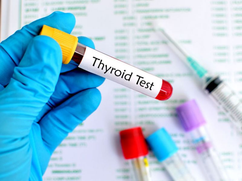 Thyroid Test