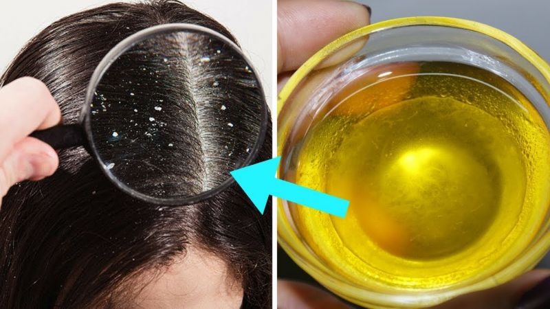 Mustard oil For Hair