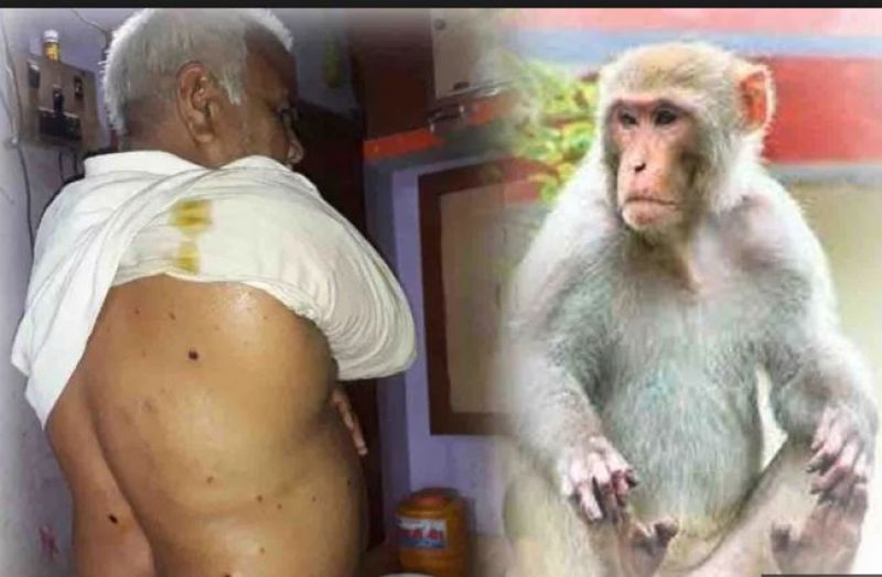 Injured Man Monkeys Attack