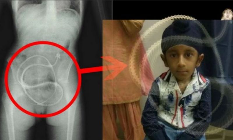 Amritsar 9 years old boy bones