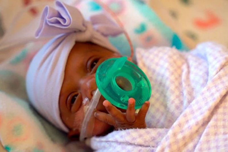 smallest surviving infant