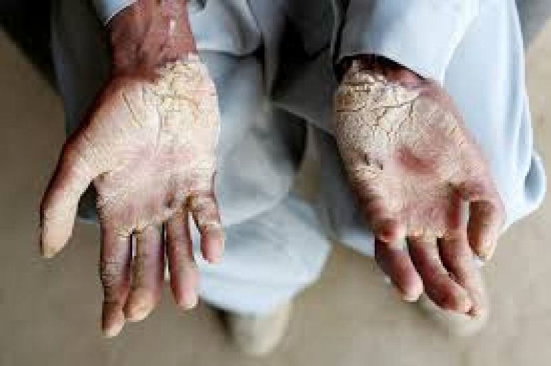 poisoning water fact