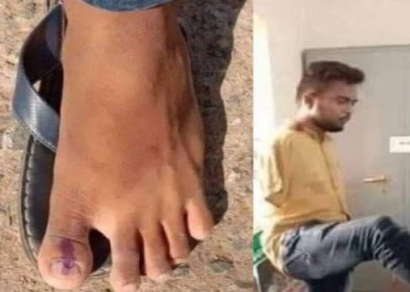 This is patriotism, strong democracy, despite being disabled