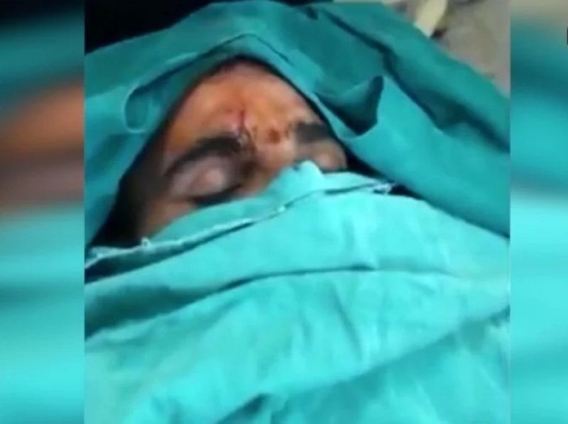 Can Not play IPL Mohammed Shami