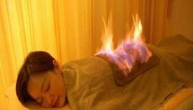 Fire therapy in china