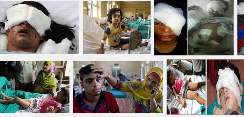 Kashmir pellet guns injure eyes