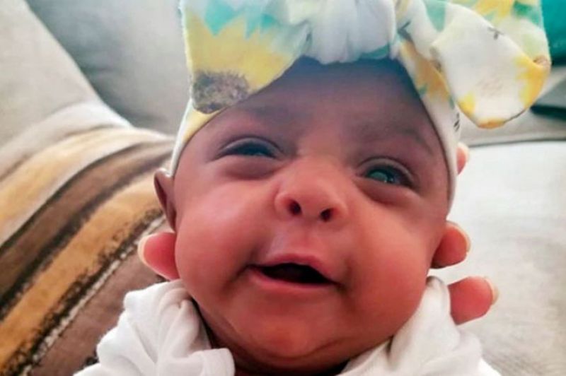 smallest surviving infant