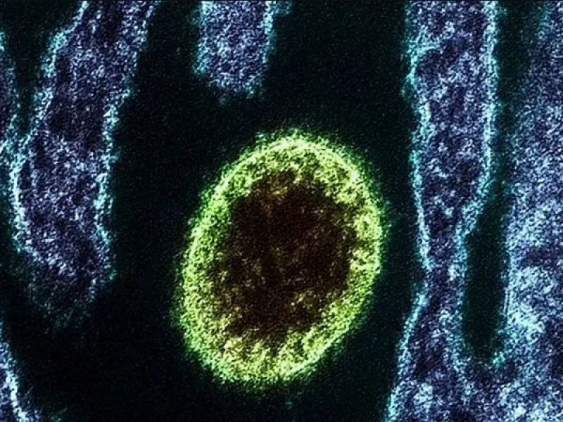  Zoonotic Langya Virus Found in China