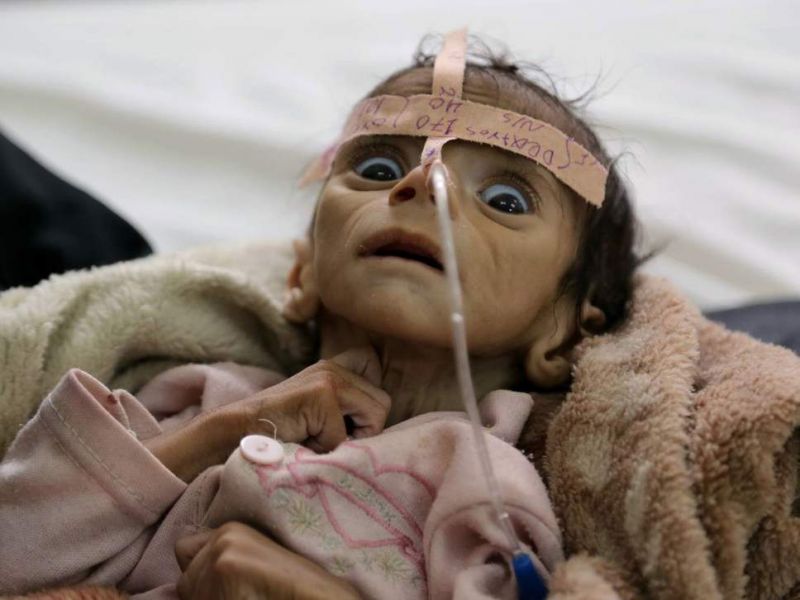 More than five million children in Yemen risk starving