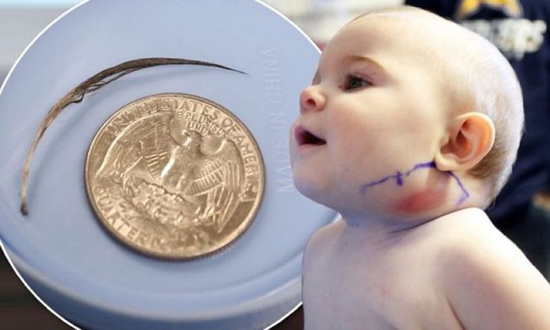 money stuck in child's neck