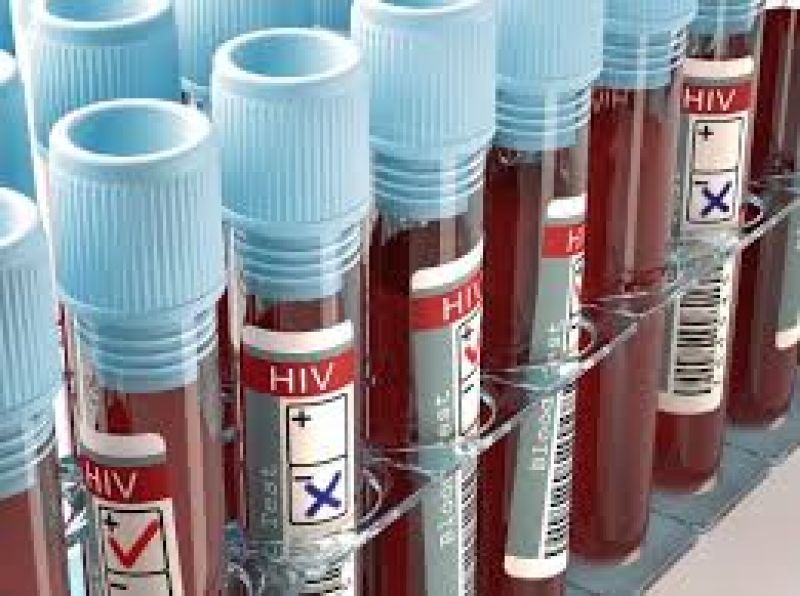 HIV Blood Test