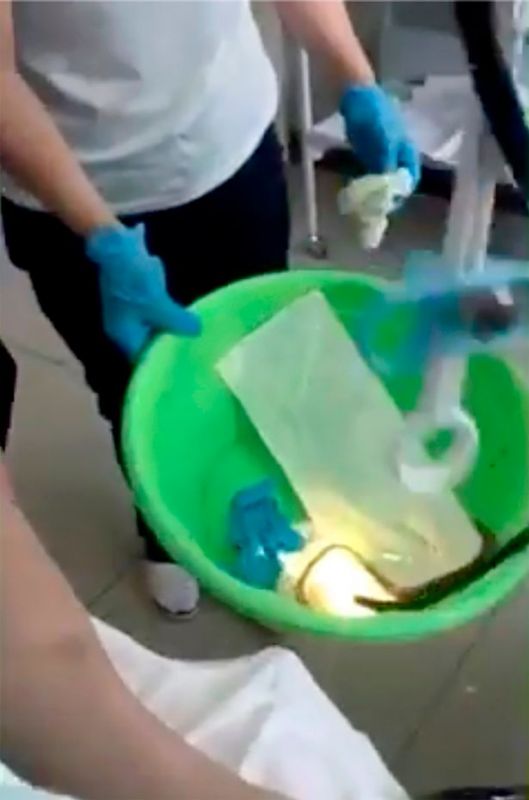 Doctors Pull 4-Feet Snake Out of Woman’s Mouth in Russia