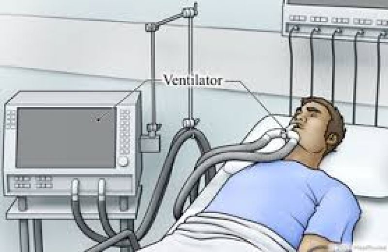 ventilator