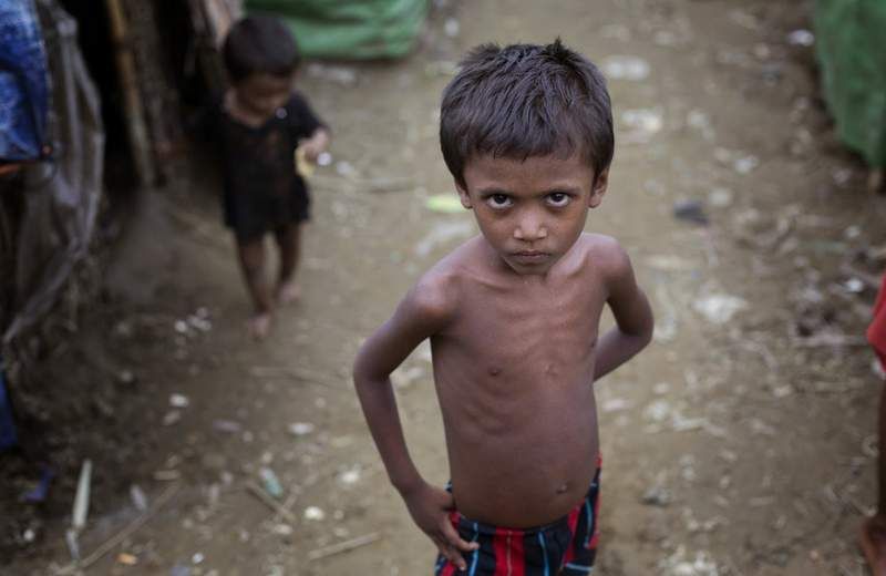 Malnourished Children