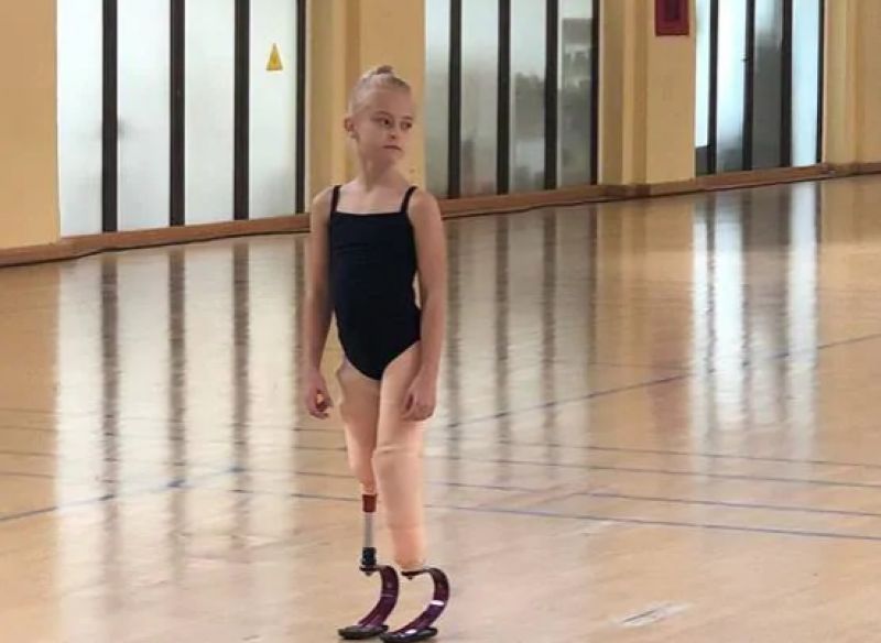 Girl lost both legs rare disease walk new york fashion week