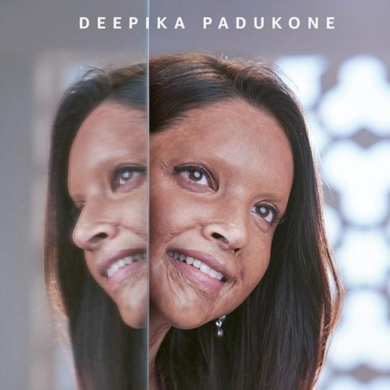 Chhapaak Movie