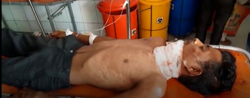 Attempts to present his own head