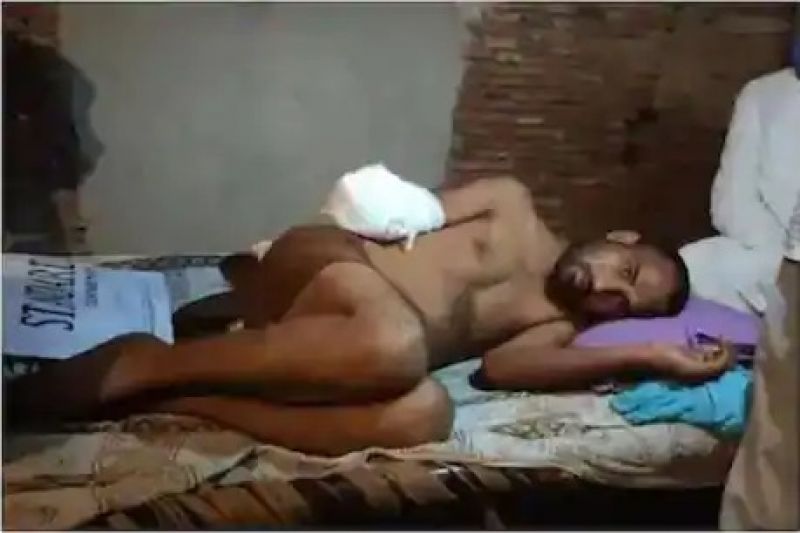 Panipat Man Says Hand Chopped Off for '786' Tattoo, Family Denies Claim He Sexually Assaulted Minor Boy